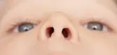 Small-child-nostrils.webp