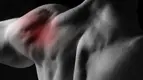 Shoulder Inflammation