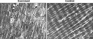 Image of muscle after eccentric exercise