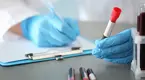 Test-Tube-Blood-Exam