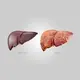 liver.webp