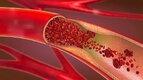 Thread 'Is Cholesterol Theory Completely Wrong?'