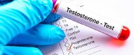 Testosterone Test